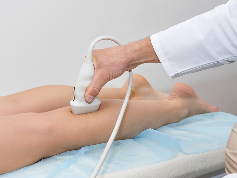 mejor angiologo en leon