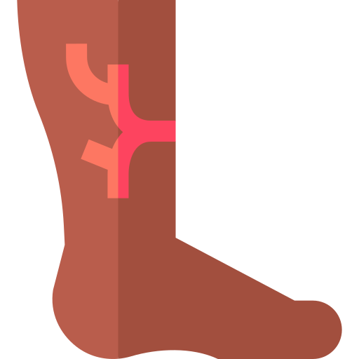 tratamiento de escleroterapia